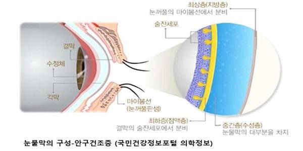 봄바람에 이유없이 눈물이 난다면…나도 ‘눈물흘림증’?