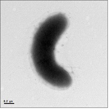 난배양성 미생물 SH-48의 투과전자현미경 사진 [출처=국립낙동강생물자원관]