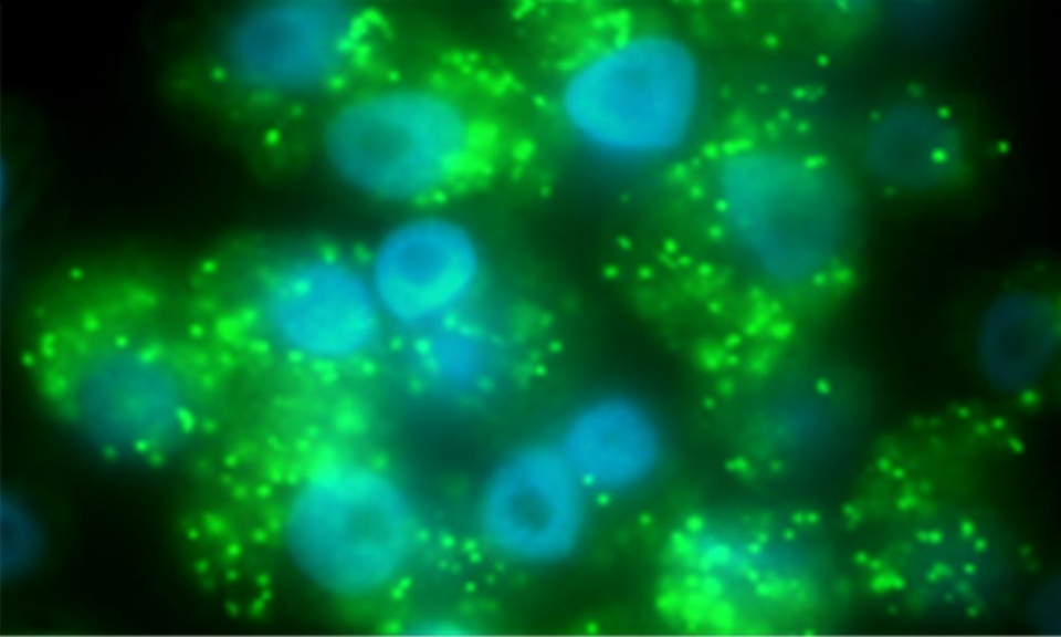 볼바키아의 형광현미경 사진. 숙주 세포 핵(파랑색)과 세포질에 있는 볼바키아(연두색). (사진 국립생태원 제공)/그린포스트코리아