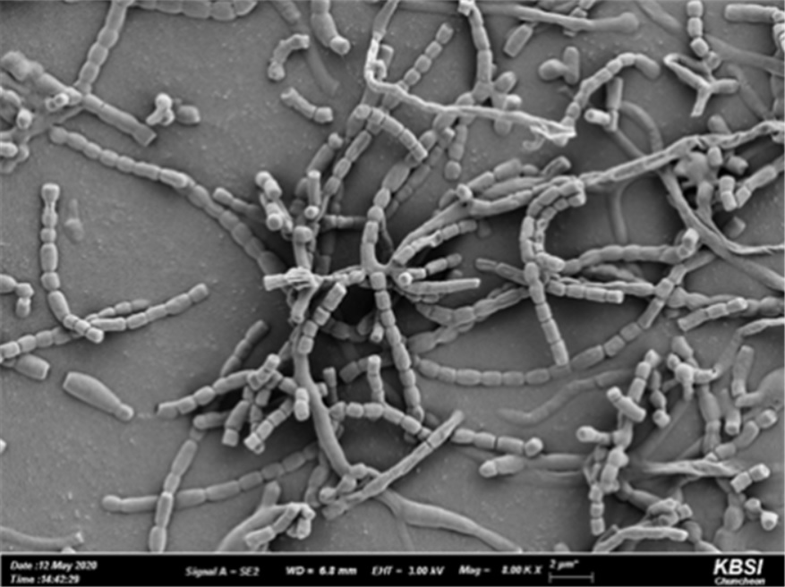균주 SJ1-7 포자의 주사전자현미경 사진(국립생물자원관 제공)/그린포스트코리아